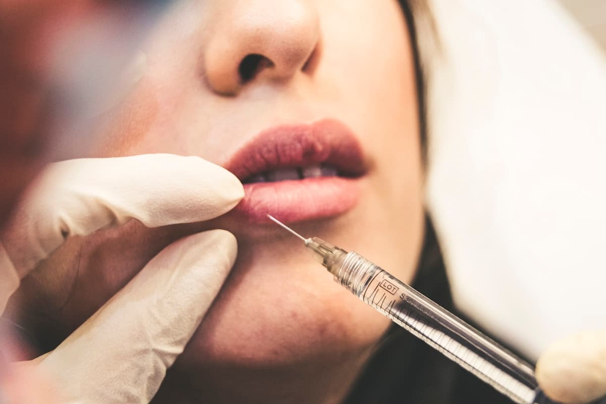 Lip filler injection at Illari Aesthetics Chicago